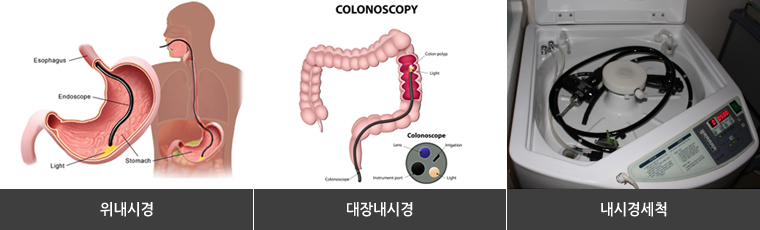 내시경관련사진